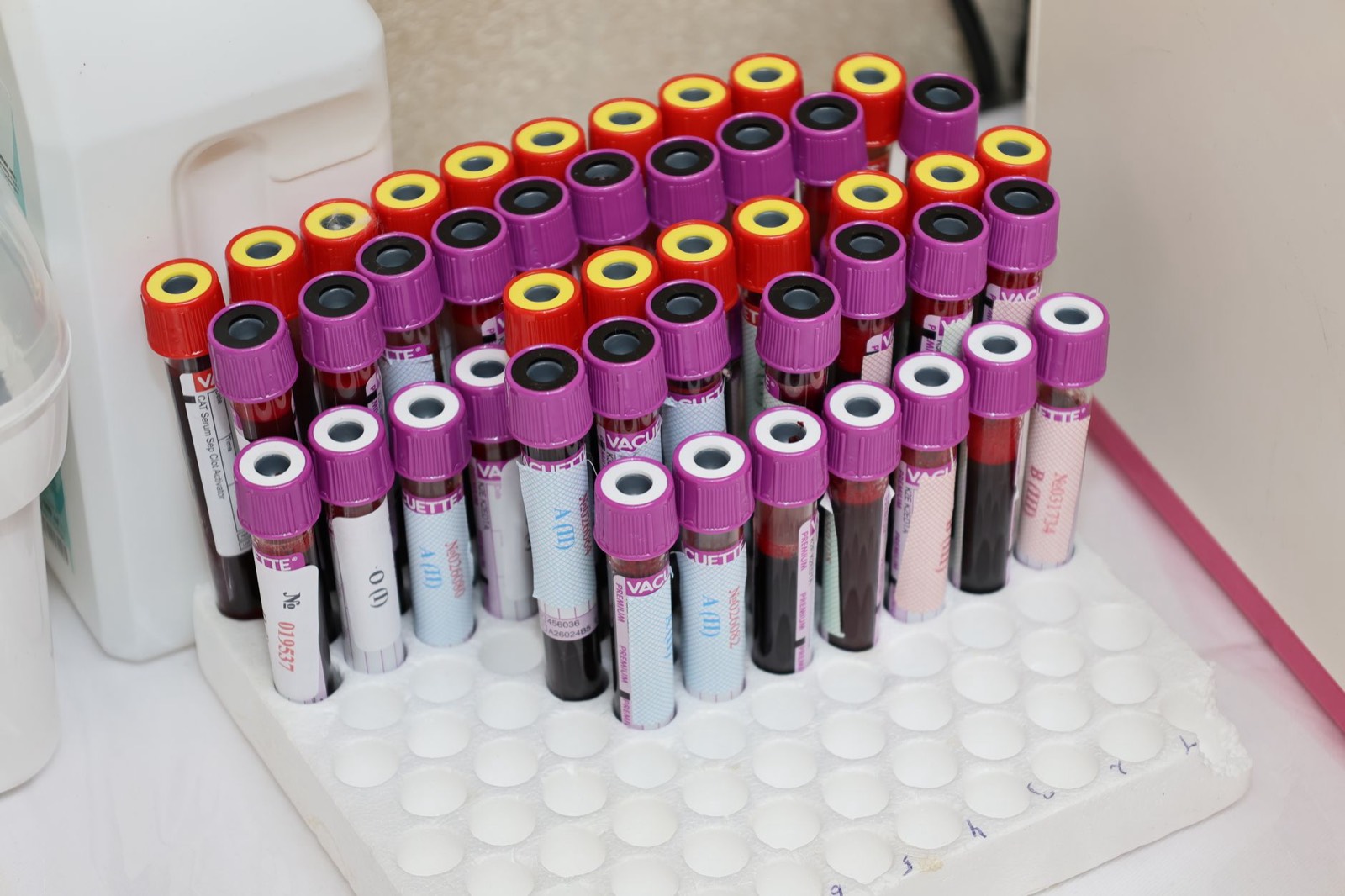 Tubes de prélèvement sanguin alignés dans un laboratoire d'analyses pour un dosage de testostérone